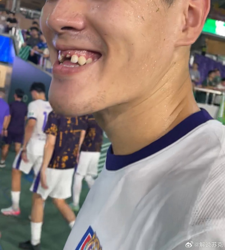 記者：王獻(xiàn)均門(mén)牙留在了黃龍?bào)w育中心，很多人一起找都沒(méi)找到
