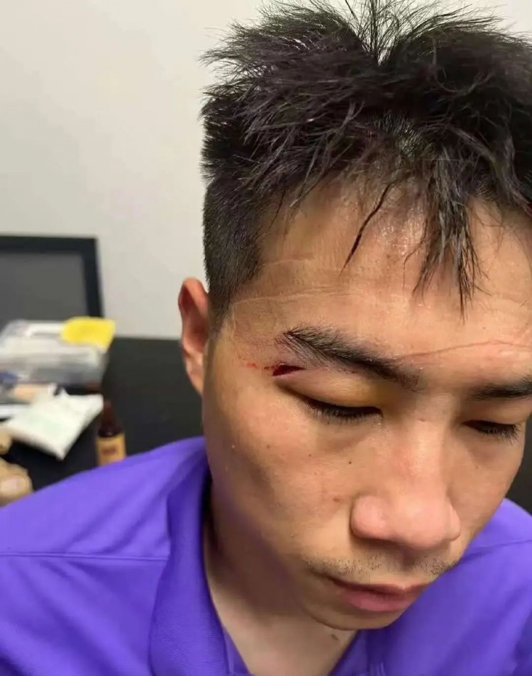 津媒：王獻鈞兩顆門牙被撞斷，楊帆眉骨受傷賽后去醫(yī)院縫針